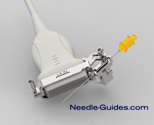 A needle guide mounted on a linear ultrasound transducer.