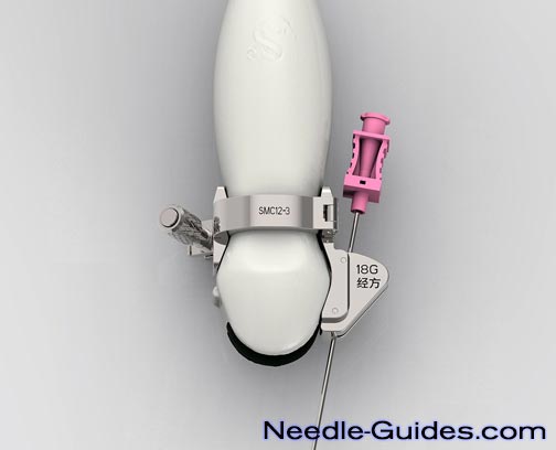A needle guide mounted on a microconvex ultrasound transducer.